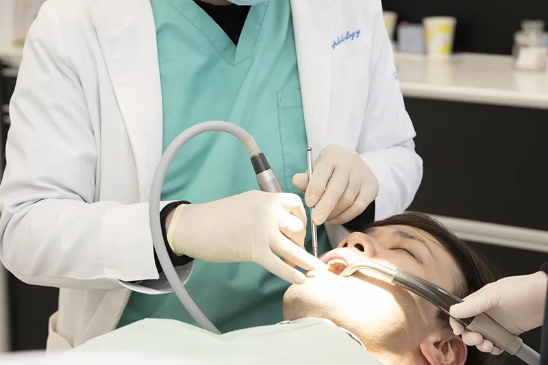 スケーリング（歯石除去）